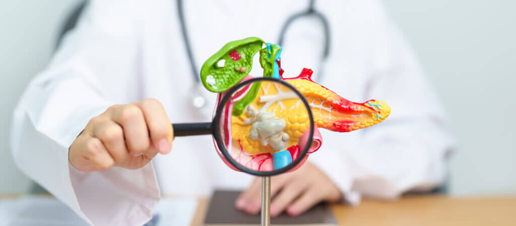 doctor with human pancreatitis anatomy model with 2025 03 08 04 22 44 utc